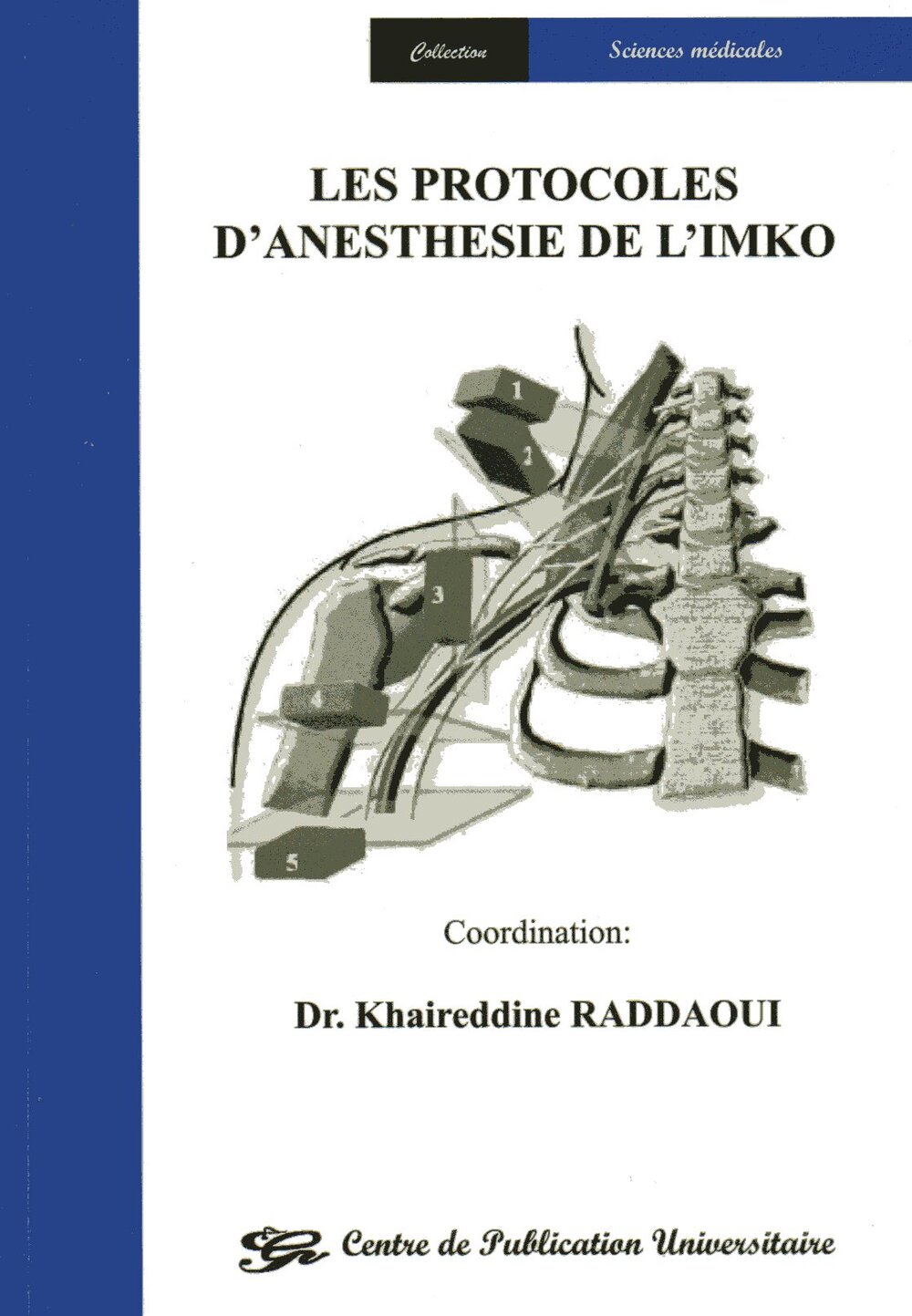 Les protocoles d'anesthésie de l'IMKO