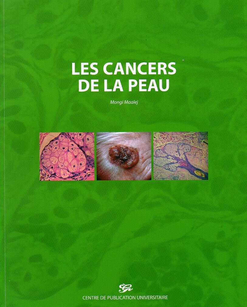 Les cancers de la peau