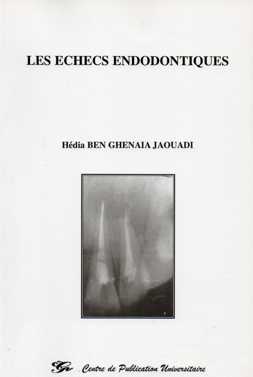 Les échecs endodontiques