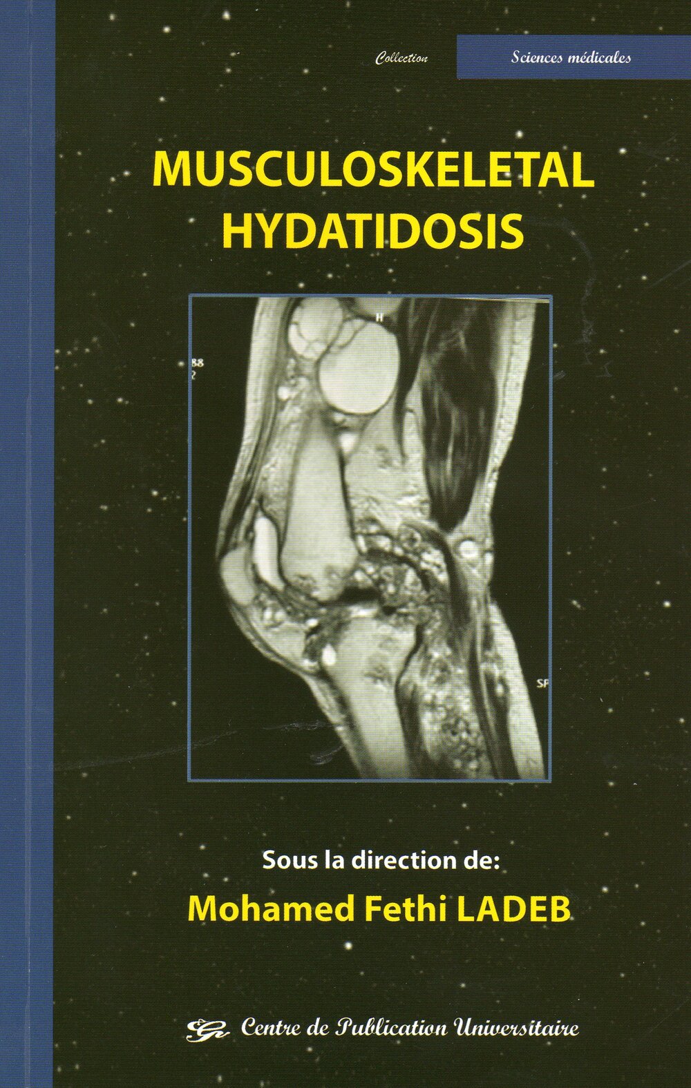 Musculoskeletal Hydatidosis