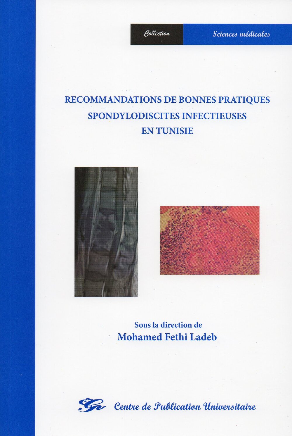 Recommandations de bonnes pratiques spondylodiscites infectieusses en Tunisie
