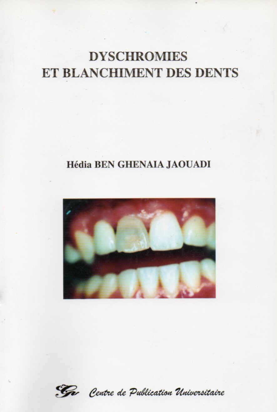 Dyschromies et blanchiment des dents