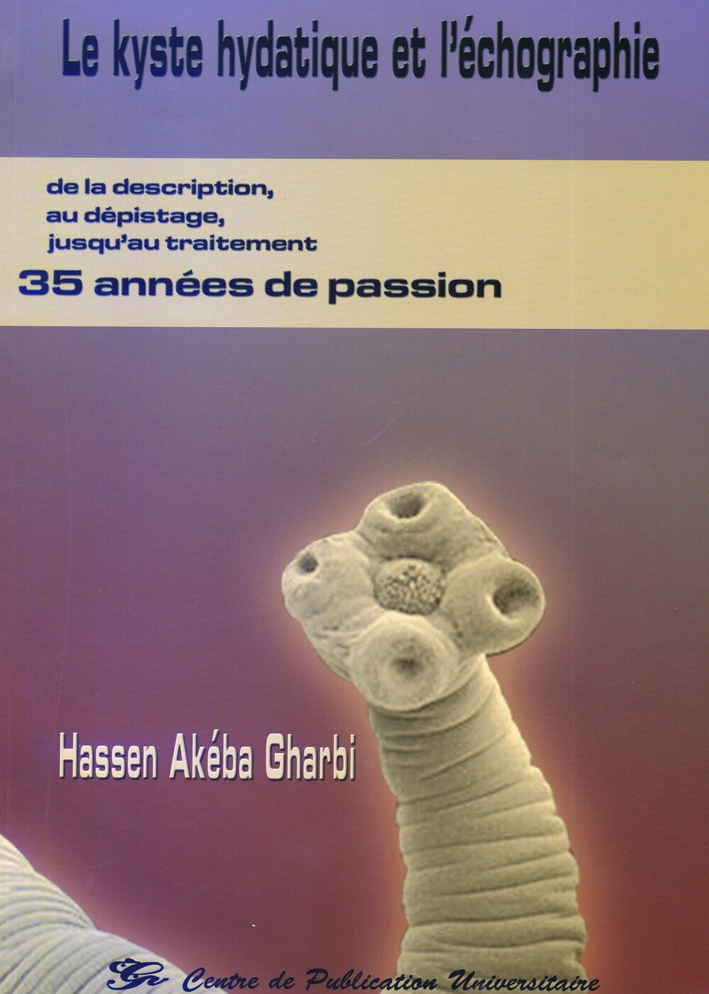 Le kyste hydatique et l'échographie. De la description, au dépistage, jusqu’au traitement 35 années de passion